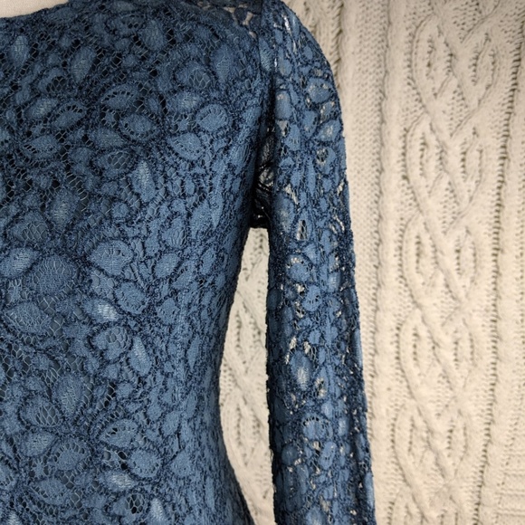Talula Aritzia Blue Lace Dress 2 - Picture 2 of 8